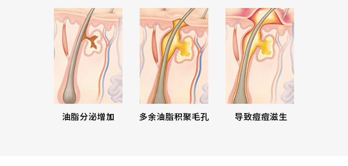 朵旎祛痘修護原液 朵旎祛痘修護原液